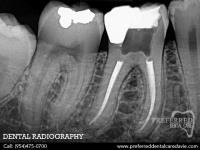 Preferred Dental Care image 11